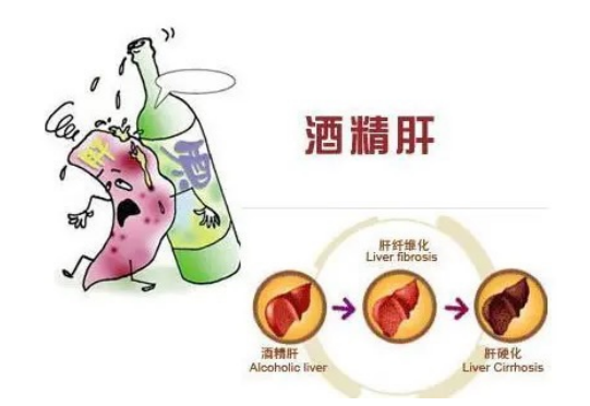 肝之殤：一個(gè)勞模器官的血淚控訴